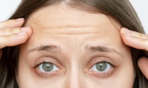 Read more about the article How Botox Can Help Smooth Out Frown Lines for a Youthful Look
