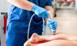 Read more about the article Is Acoustic Wave Therapy Covered by Insurance? A Practical Breakdown