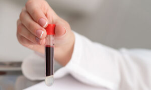 Read more about the article Is Platelet-Rich Plasma Covered by Insurance? Coverage Details