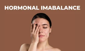 Read more about the article Why Hormonal Imbalance Is More Common Than You Think