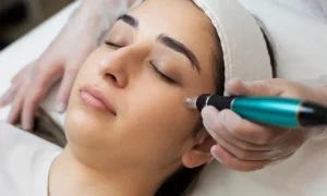 Read more about the article What to Do After Microneedling: An Aftercare Guide