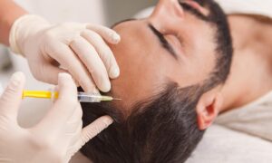 Read more about the article PRP Hair Restoration: How It Supports Natural Hair Growth