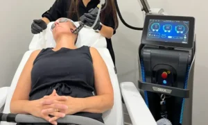 Read more about the article Tetra CoolPeel Laser in Woodbury, NY for Smoother, Brighter Skin